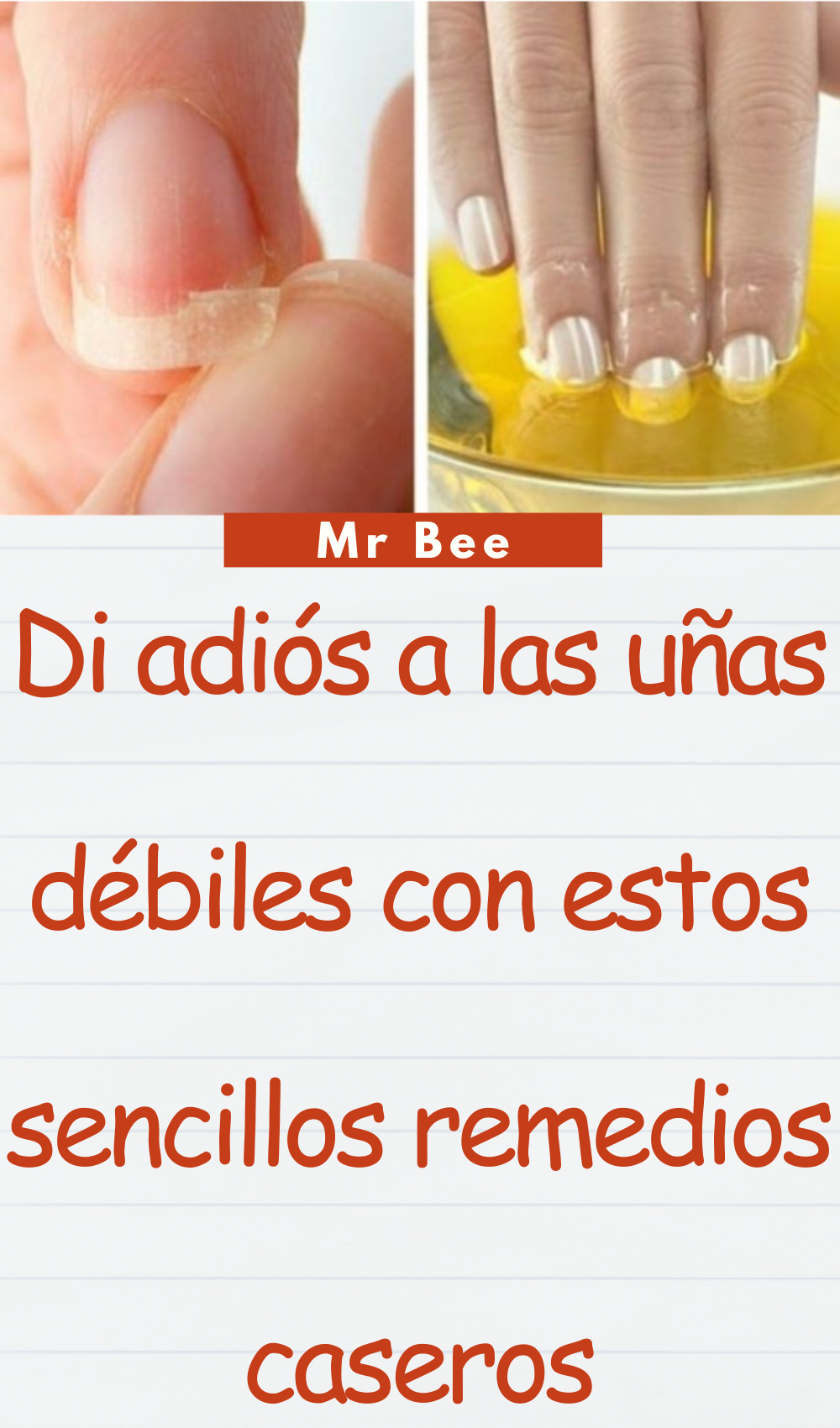 Yo misma sane mis venas varicosas mi vecina y mi doctor me están pidiendo la receta dia y noche (1000 x 1700 px) (1000 x 1700 px) (11)