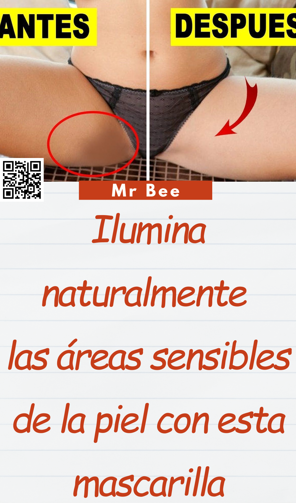 Yo misma sane mis venas varicosas mi vecina y mi doctor me están pidiendo la receta dia y noche (1000 x 1700 px) (1000 x 1700 px) (2)
