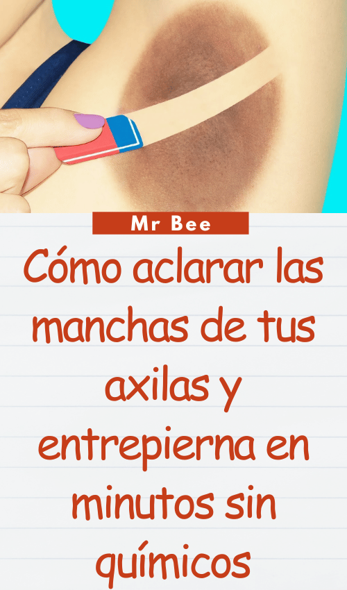 image-axilas-103124-11