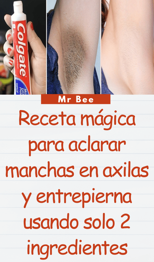 image-axilas-103124-15