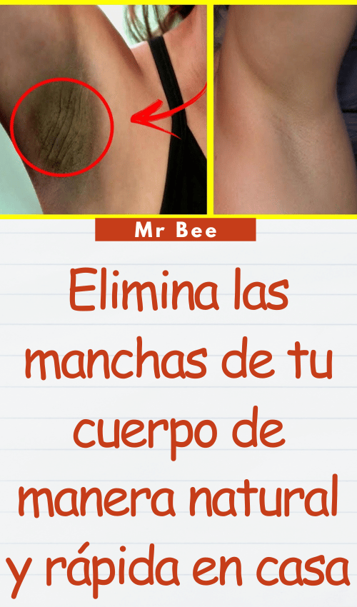 Elimina las manchas de tu cuerpo de manera natural y rápida en casa image-axilas-103124-16