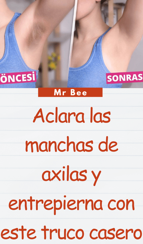 image-axilas-103124-25