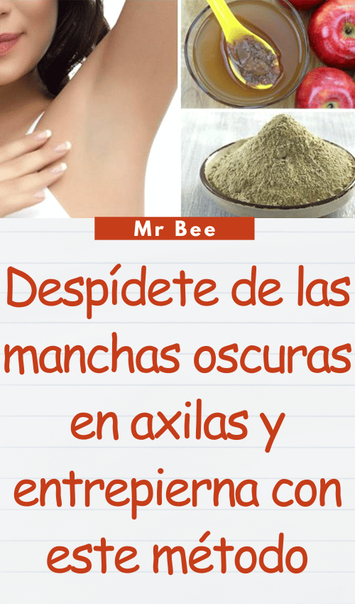 image-axilas-103124-31