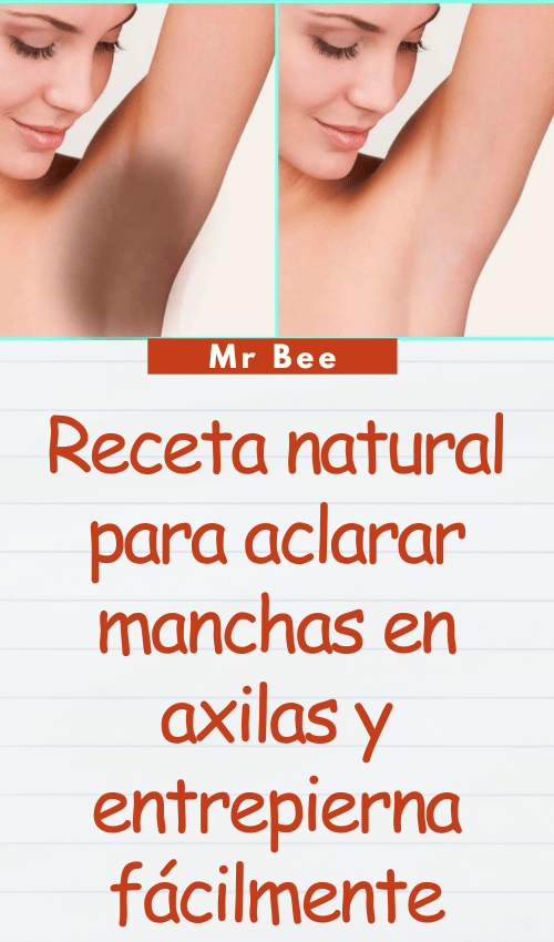 image-axilas-103124-32
