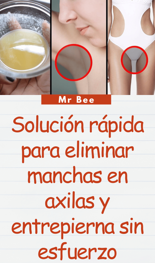 image-axilas-103124-34