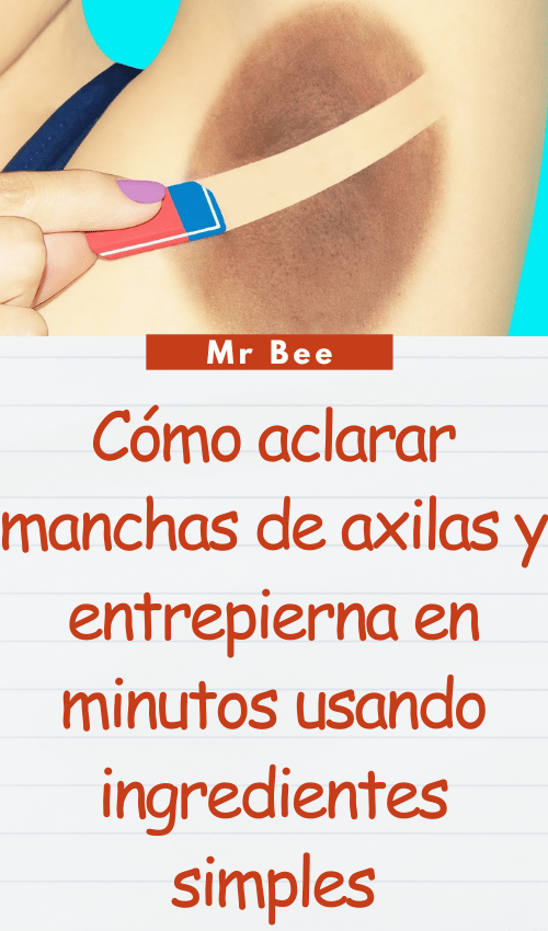 image-axilas-103124-35