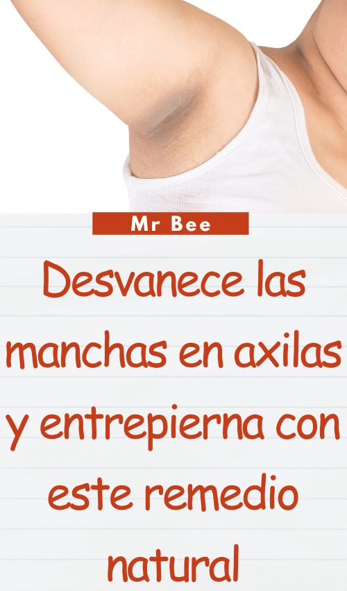 Desvanece las manchas en axilas y entrepierna con este remedio natural image-axilas-103124-36