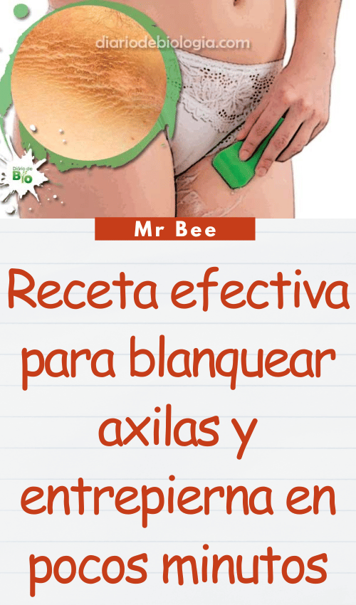 Receta efectiva para blanquear axilas y entrepierna en pocos minutos image-axilas-103124-37