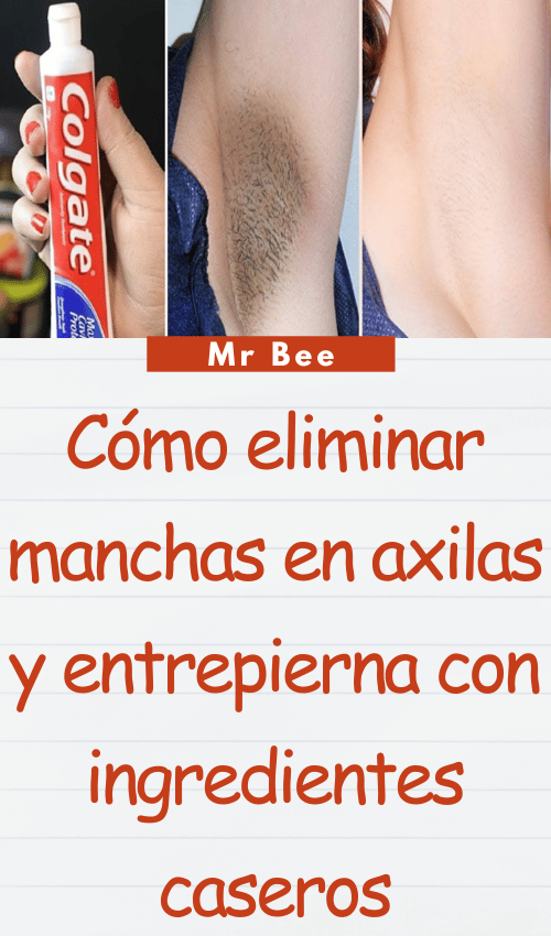 image-axilas-103124-39