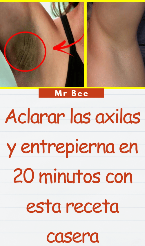 image-axilas-103124-40