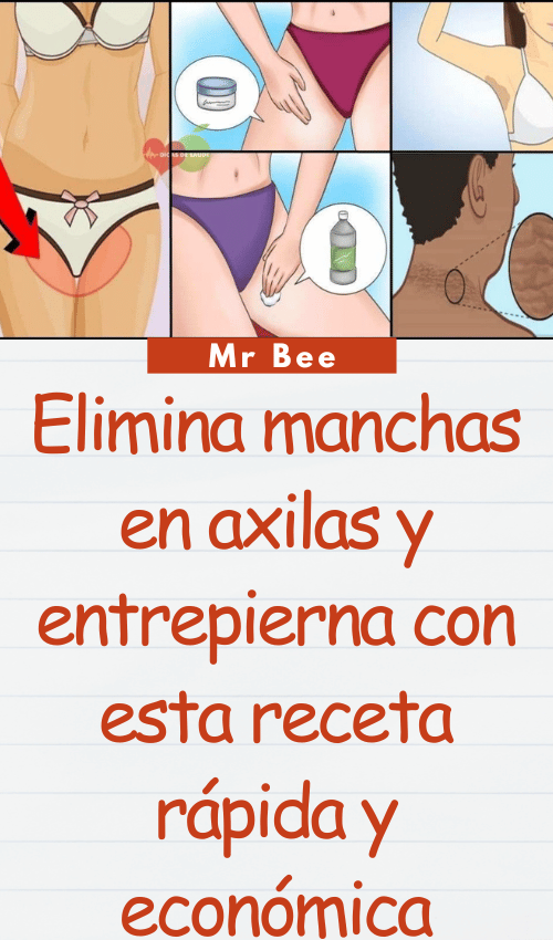 image-axilas-103124-45