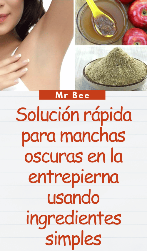 image-axilas-103124-7