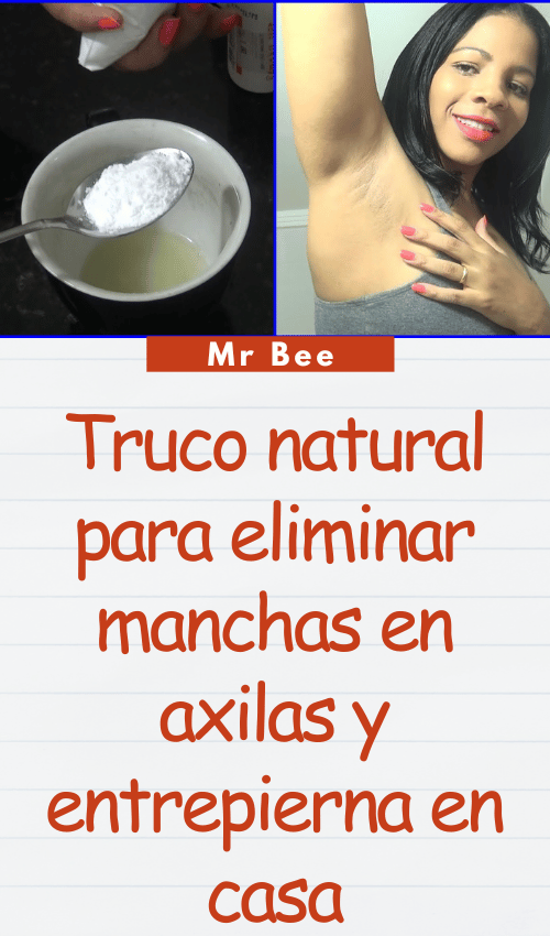 image-axilas-103124-9