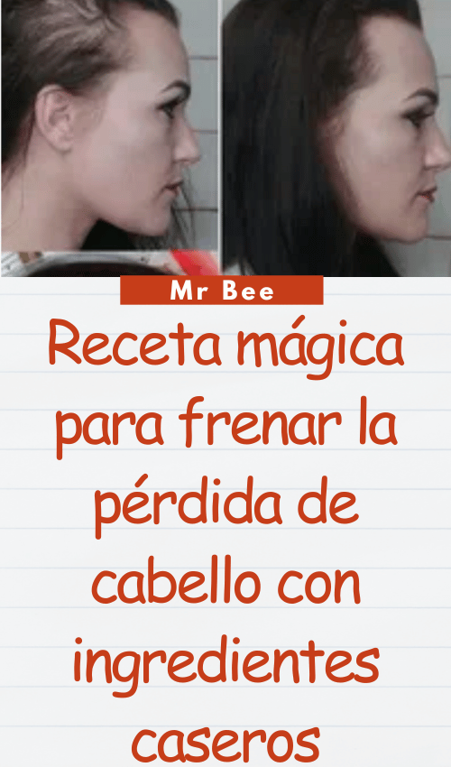 image-cabello-103024-1