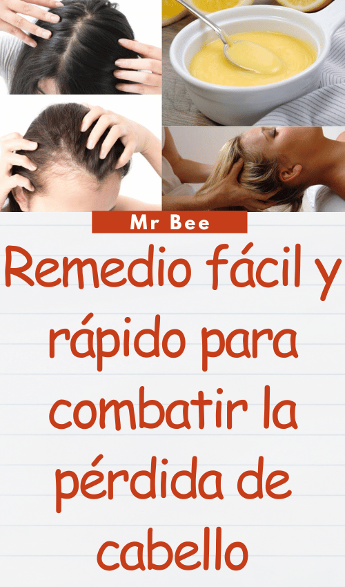Remedio fácil y rápido para combatir la pérdida de cabello image-cabello-103024-12