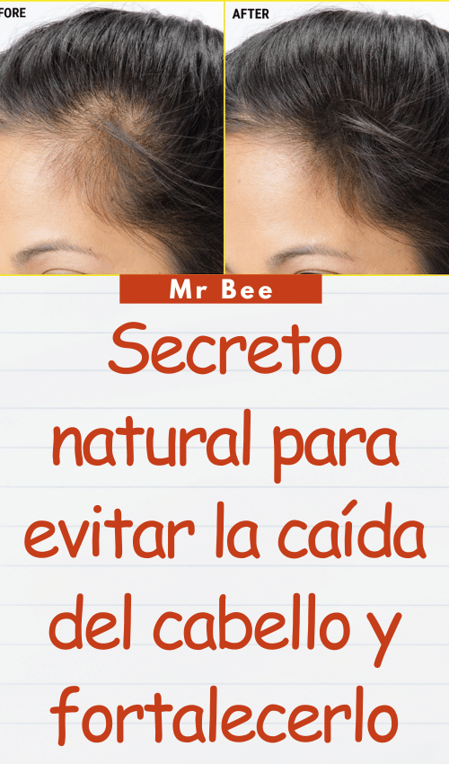 image-cabello-103024-13