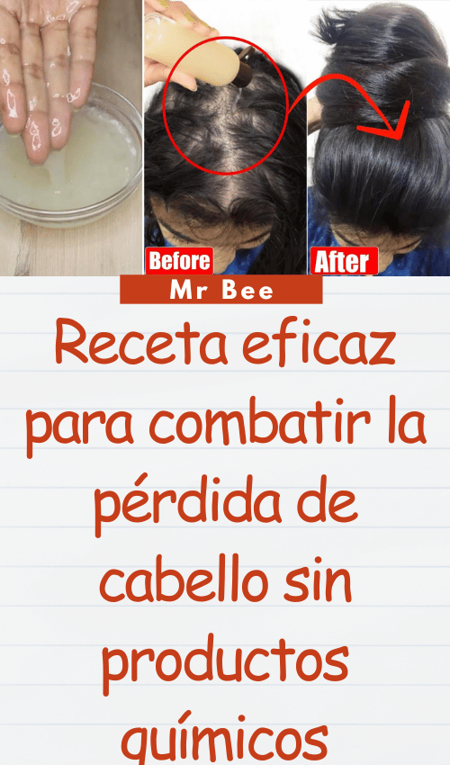 Receta eficaz para combatir la pérdida de cabello sin productos químicos image-cabello-103024-16