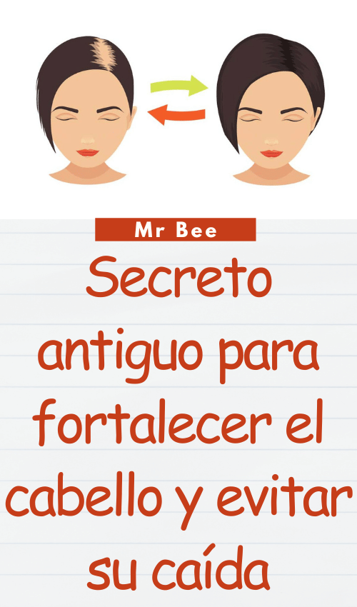 image-cabello-103024-2