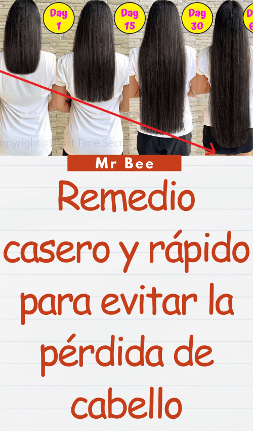 Remedio casero y rápido para evitar la pérdida de cabello image-cabello-103024-20