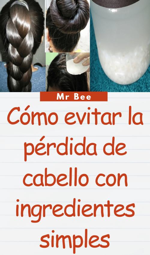 image-cabello-103024-22