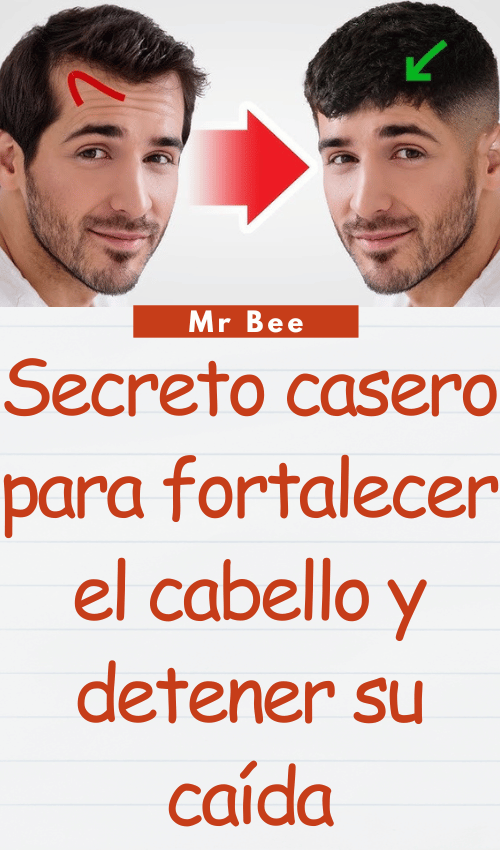 Secreto casero para fortalecer el cabello y detener su caída image-cabello-103024-26