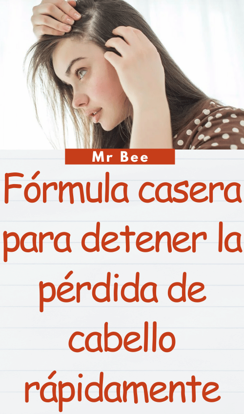 Fórmula casera para detener la pérdida de cabello rápidamente image-cabello-103024-3