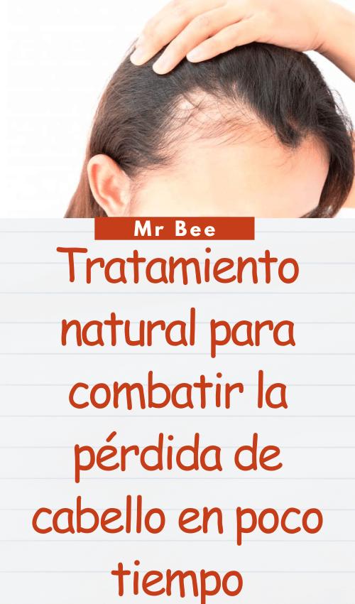 image-cabello-103024-30