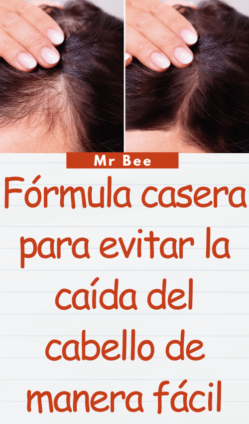Fórmula casera para evitar la caída del cabello de manera fácil image-cabello-103024-31
