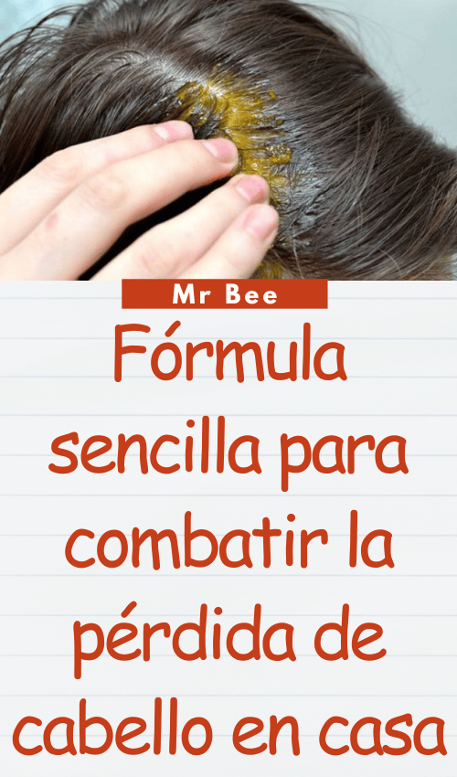 Fórmula sencilla para combatir la pérdida de cabello en casa image-cabello-103024-35