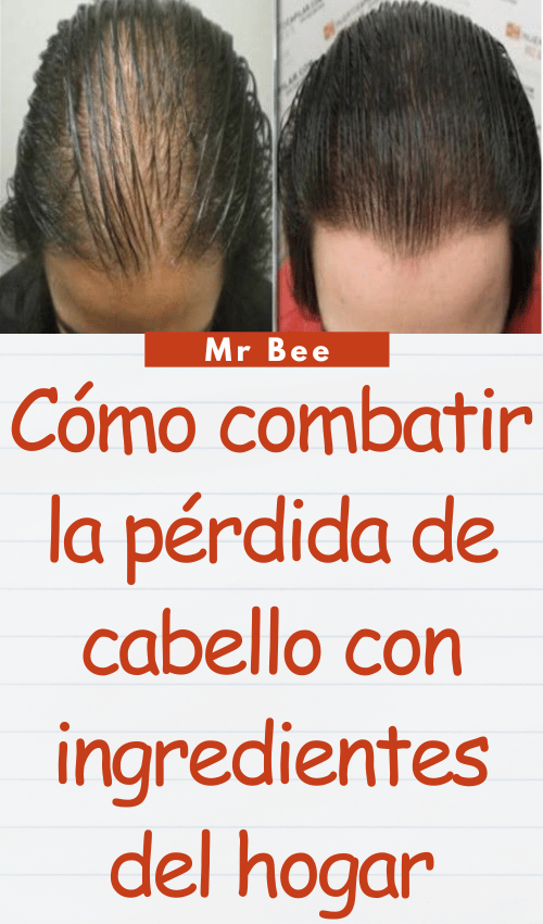 image-cabello-103024-38