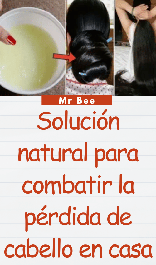 image-cabello-103024-4
