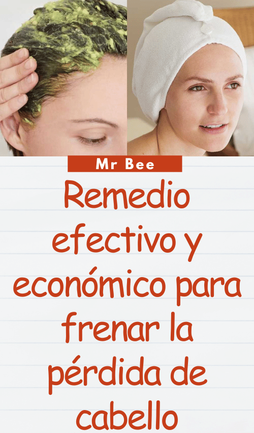 image-cabello-103024-43