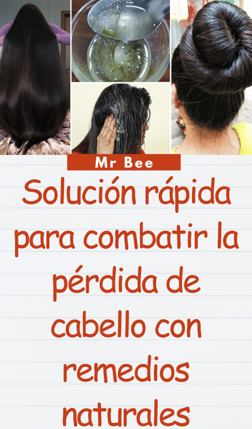 image-cabello-103024-44