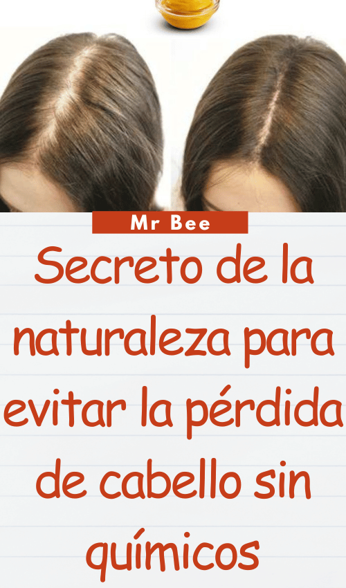 Secreto de la naturaleza para evitar la pérdida de cabello sin químicos image-cabello-103024-46