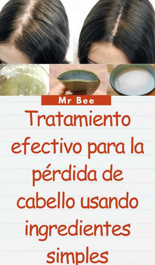 Tratamiento efectivo para la pérdida de cabello usando ingredientes simples image-cabello-103024-5