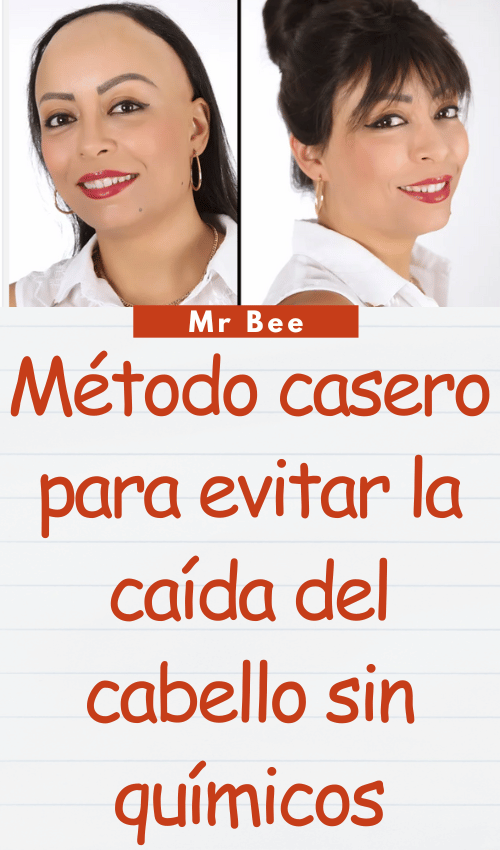 Método casero para evitar la caída del cabello sin químicos image-cabello-103024-6