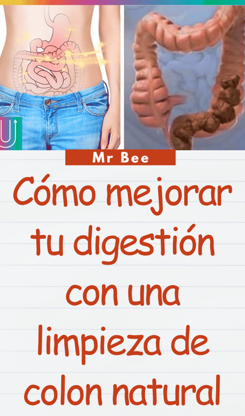 image-colon-110224-37