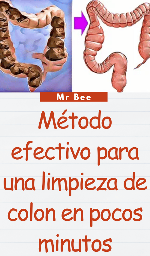 image-colon-110224-7